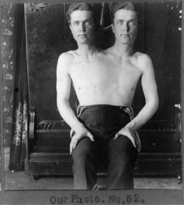 A-two-headed-man.-600x669