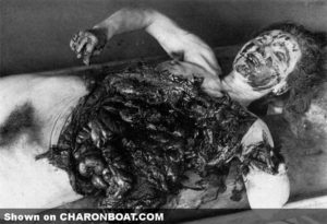 Unit 731- russian woman prisoner